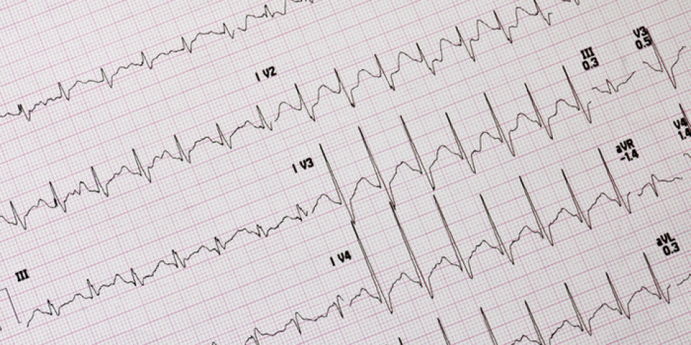 Elettrocardiogramma in telemedicina salva la vita a un uomo di Linosa